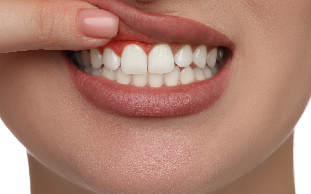 Periodontal Therapy in Sacramento: Your Guide to Battling Gum Disease for Supreme Oral Health