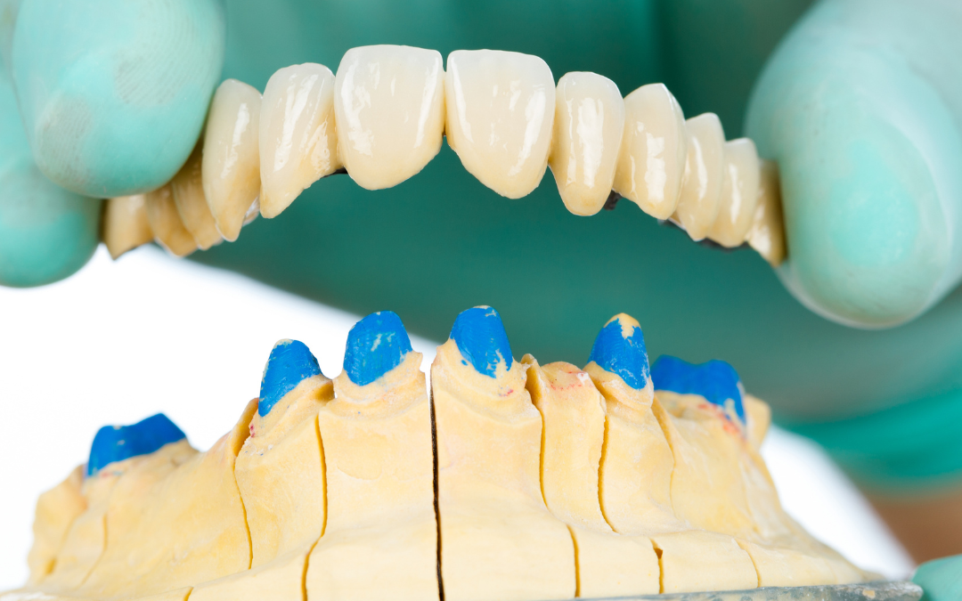 Enhancing Smiles: Exploring Dental Crowns and Bridges at GT Dental Studio in Sacramento, CA