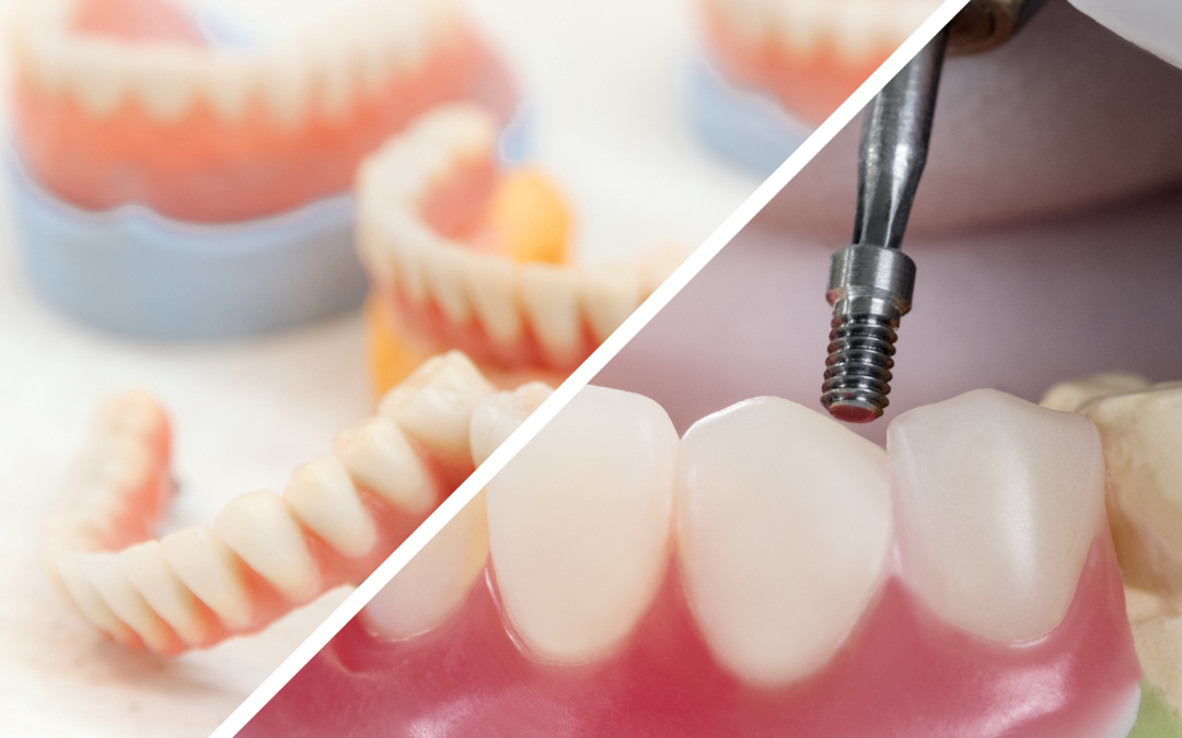 Dental Implants vs. Dentures: Making the Right Choice for You
