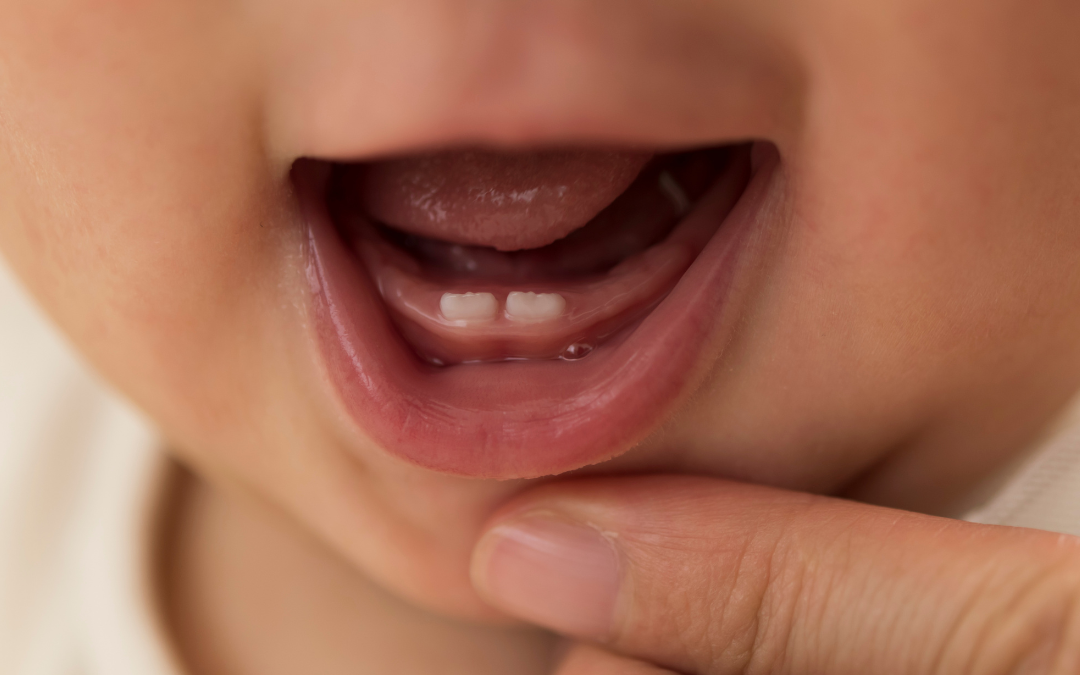 Caring for Your Child’s First Teeth: A Guide by GT Dental Studio for Parents and Caregivers