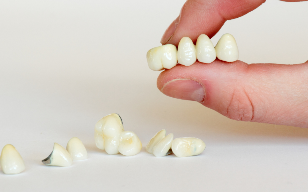 Choosing the Right Crown: An Expert Overview with GT Dental Studio